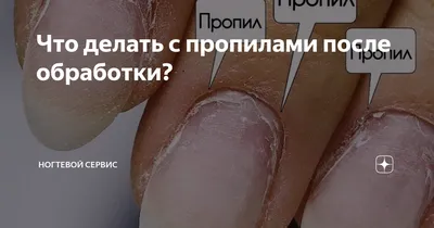 КОЗЫРЬКОВЫЙ ПРОПИЛ😩ПОЧЕМУ?🤔инст:valerie.nailss🤎#пропилынаногтях #но... |  TikTok