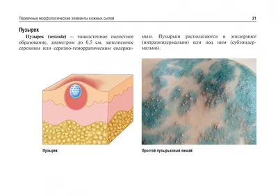 Вирусные дерматозы - online presentation