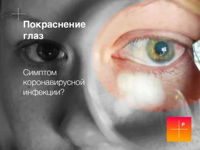 Как лечить простуду на глазу? «Ochkov.net»