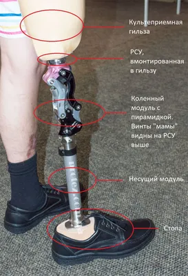 Новый адаптер позволит людям с ампутацией ног быстро и легко менять свои  протезы :: Реабилитационная индустрия России