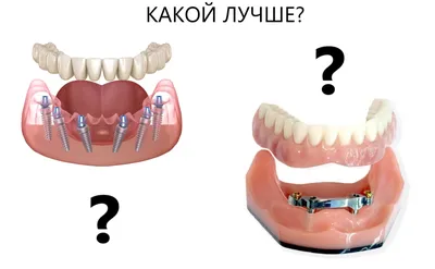 Съемное протезирование (полное, частичное)