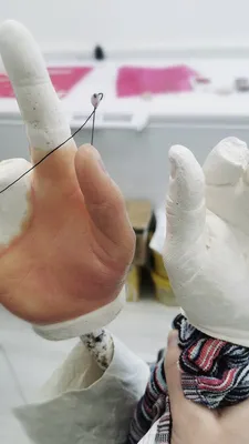 Бионический протез руки MAXBIONIC - краудфандинговый проект на Boomstarter