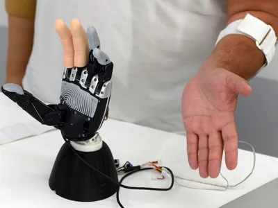 Тяговые протезы для детей и взрослых, выполненные на 3D-принтере / Хабр