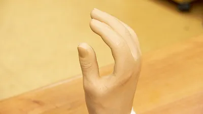 ИИ открывает новые возможности для протезирования с помощью напечатанной на  3D-принтере руки - Unite.AI