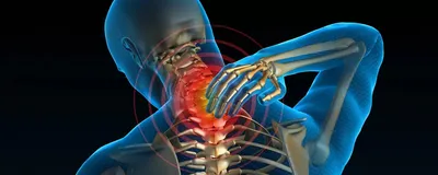 Протрузия шейного отдела в Москве, лечим протрузии в клинике Доктор Длин
