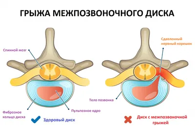 При... - Центр оздоровительной физкультуры Симметрия | Facebook