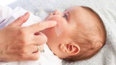 Сыпь на ладонях у ребенка - основные причины появления