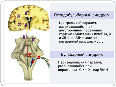 Презентация по неврологию | PDF