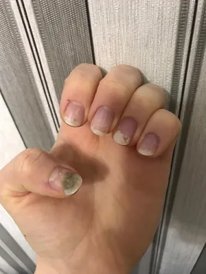 Green nail under gel 😮 / Pseudomonia on nails - YouTube