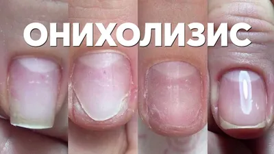 НАРАЩИВАНИЕ НОГТЕЙ МАНИКЮР ГОРЯЧИЙ КЛЮЧ (@tanechkanails_) • Instagram  photos and videos