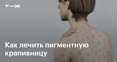 Психосоматика кожных болезней | Сайт психологов b17.ru | Дзен
