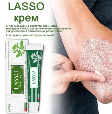 Псориаз экзема крем для кожи дерматита онихомикоз паронихия экзема кожу  дерматита топового дерматита | AliExpress