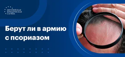 Симптомы и лечение псориаза. Что такое псориаз и кто к нему  предрасположен?: Уход за собой: Забота о себе: Lenta.ru