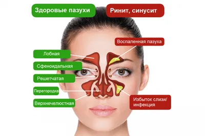 Кожные заболевания: герпес - Клиника ТРИНИТИ (Москва)