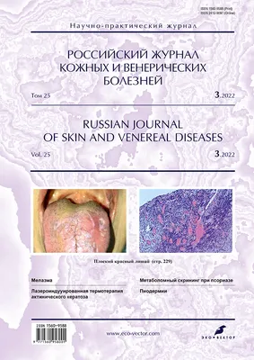 The effectiveness of the IL-17A inhibitor in generalized pustular  psoriasis: a clinical case - Olisova - Russian Journal of Skin and Venereal  Diseases