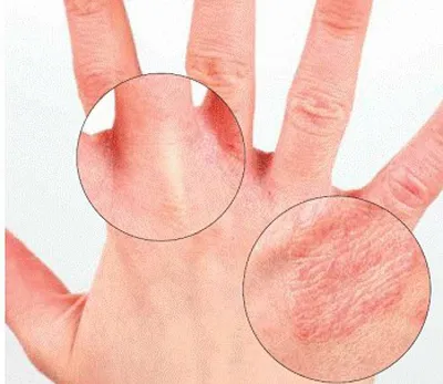 Болезни ногтей на руках и связь с внутренними органами