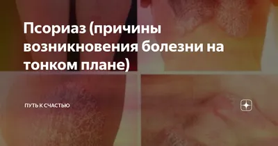 Псориаз: эффективное лечение, мазь от псориаза, псориаз на голове и других  частях тела