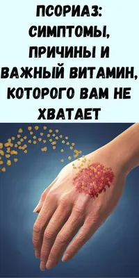 On Clinic Bishkek - Что делать, псориаз отравляет жизнь и не дает одеть  открытую одежду? . 👉Псориаз — хроническое заболевание кожи, которое может  иметь самые разные причины. Его диагностируют в любом возрасте