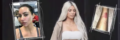 Ким Кардашян на снимке без косметики продемонстрировала следы псориаза