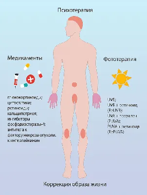 Псориаз и жизнь с ним | Пикабу