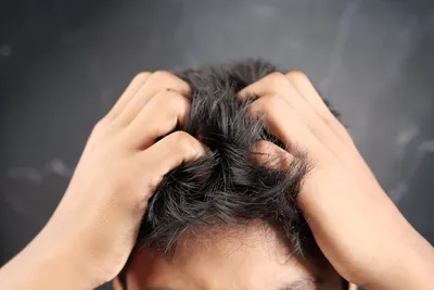 Диагноз: Псориаз волосистой части головы;промежуточный результат за 2  недели.😍☺Цель: вывести в длительную ремиссию💪.. | ВКонтакте