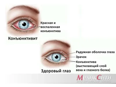 Отделение МНТК \"Микрохирургия глаза\" в г. Саранск