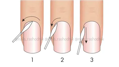Отслойка материала от ногтевой пластины