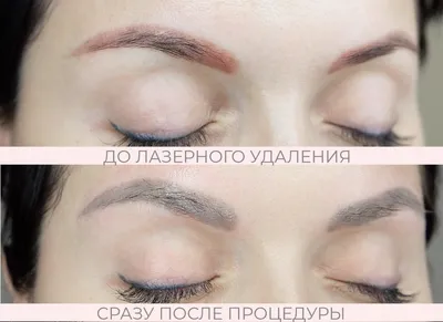 Перманентный макияж бровей в Минске - Татуаж бровей, цена