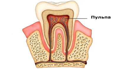 Пульпит симптомы фото фото