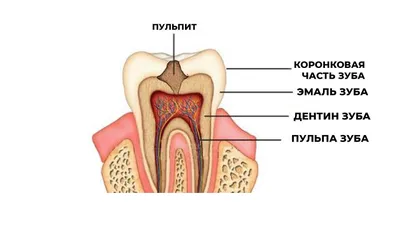 Пульпит