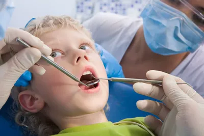 Лечение пульпита молочных и постоянных зубов у детей. Цены
