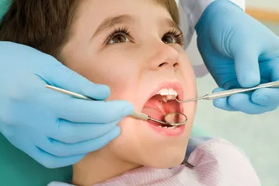 Цена на лечение пульпита молочных зубов в детских стоматологиях Вероника
