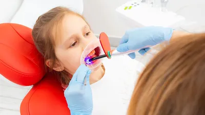 Лечение пульпита постоянных зубов у детей - стоимость услуг в Москве