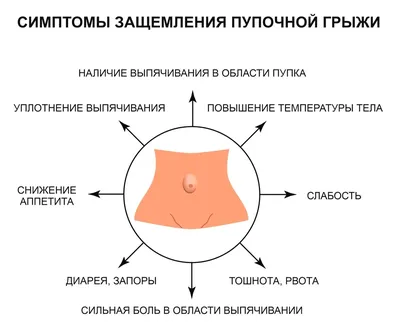 Операция по удалению пупочной грыжи (герниопластика) у мужчин и женщин:  питание после лечения, как делают операцию, реабилитация