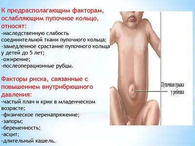 Купить Комбинированный набор пупочный ноготь пупочное кольцо простые  ювелирные изделия для пирсинга европейское и американское кольцо для пупка  кольцо для губ | Joom