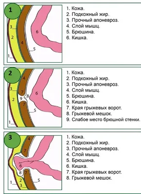 Купить Шарик из нержавеющей стали в форме сердца, пупочное кольцо, пирсинг  пупка, кольца пупка | Joom