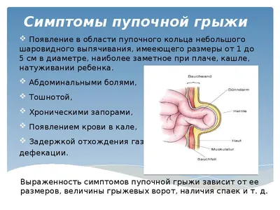 Пупочная грыжа — это расширение пупочного кольца, через которое  выпячивается содержимое брюшной полости. Результат на 6 день 😍 Запись:… |  Instagram