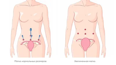 Пластика пупка в Москве - цены в Damas Clinic | Стоимость проведения  умбиликопластики