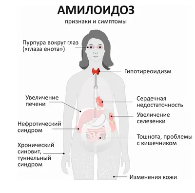 Experience of successful use of intense pulsed light in the treatment of  Shamberg patients - Arkatova - Russian Journal of Skin and Venereal Diseases