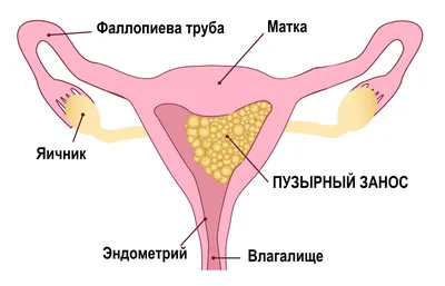 Псориаз анти зуд крем экзематоидная эцема Антибактериальная крапивница  алергия Уменьшает покраснение дерматит лечение мазь 20 г | AliExpress