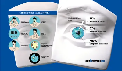 Тихий вор зрения»: что нужно знать о глаукоме | Проект +1 | Дзен