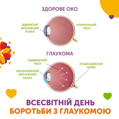 Демодекоз глаукома - Медицинский центр Медина +