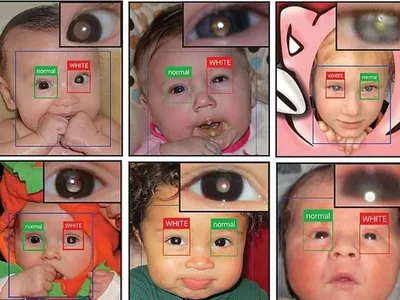 Мобильное приложение поможет диагностике редкого рака глаз у детей -  Последние новости - Ens.az - Новости и энциклопедия на 4 языках
