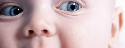 Гемангиома глаза: что собой представляет заболевание, как лечится -  Офтальмологические клиники «Эксимер» (Киев) – диагностика и лечение  заболеваний глаз у взрослых и детей