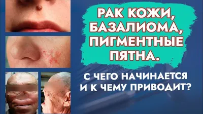 Что такое рак молочной железы у кошек и собак?