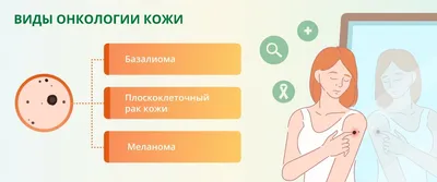 Диагностика рака кожи в Киеве - стоимость лечения | Brennerclinic