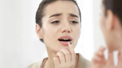 Рак полости рта: симптомы, признаки, лечение, прогноз