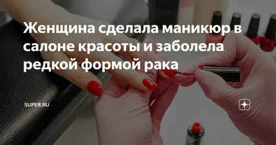 Как выглядит рак кожи — признаки и симптомы меланомы, базалиомы