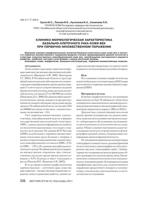 Рак глаза и глазницы: диагностика и хирургическое лечение в Одессе |  Медицинский дом Odrex