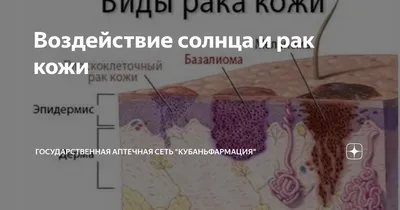 После десятилетий загара веснушка на носу женщины оказывается раком кожи |  Women Street | Дзен